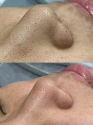 -SKIN79皮肤管理中心