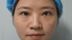 -天津健丽·去眼袋医疗美容机构