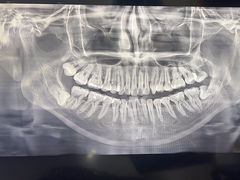 -同步齿科·数字化正畸种植口腔中心(珠海店)