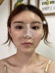 -安徽合肥韩美整形外科医院