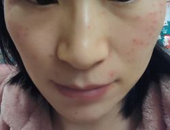 -针美汇欧邦医疗美容