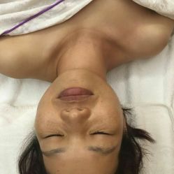 -苑苑vbeauty科技美容SPA