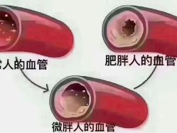 -香薇妮丝·定制减肥·身材管理