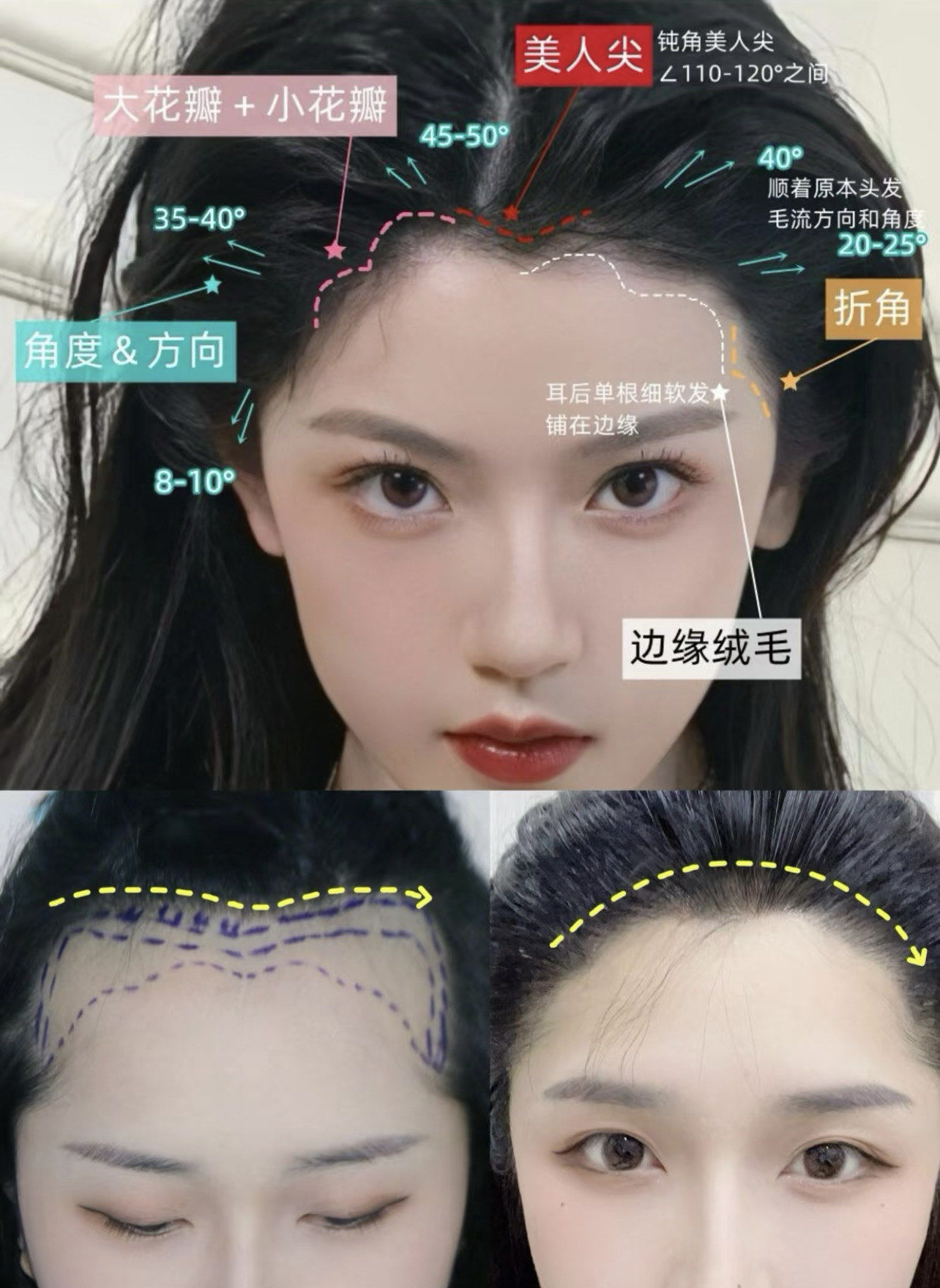 我看看谁还没有完美的发际线