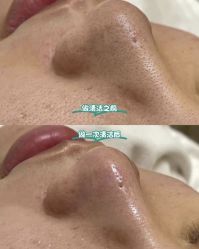-苗方清颜痘肌研究所