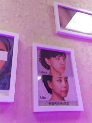 -成都西区医院整形美容