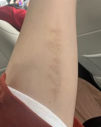 -天道专业洗纹身