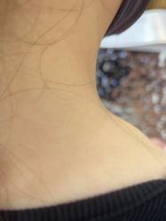 -美瑞莎创美医疗美容