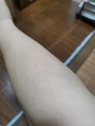 体验后-深圳春天阳光医院·轮廓抗衰中心