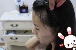 -大麦微针植发丨全国连锁