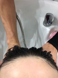 -黑奥秘脱发白发中心