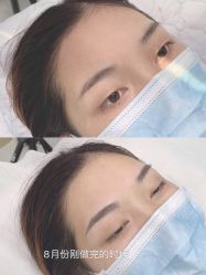 -久匠半永久纹眉