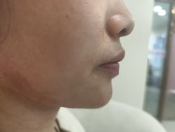 -长沙雅美医疗美容医院