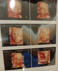 -杭州贝瑞斯美华妇儿医院·早孕·产检·儿科