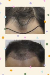 -熙朵美学植发·连锁品牌