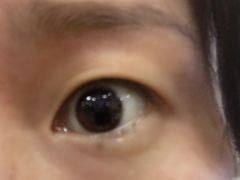 -上海大学附属上海和平眼科医院
