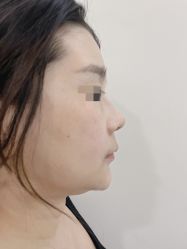 体验后-上海首尔丽格医疗美容医院