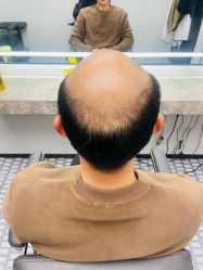 -唐风采假发补发定制