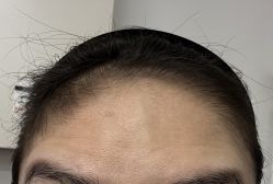 -北京润美玉之光医疗美容