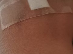 -重庆医科大学附属第一医院(本部)