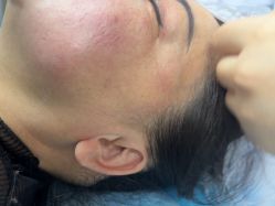 -长沙雅美医疗美容医院