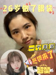 -广州健丽·去眼袋医疗美容机构
