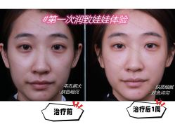 -美莱医学美容医院