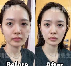 -颜和骨正&明星徒手小颜整骨