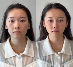 -深圳鹏爱秀琪医疗美容医院