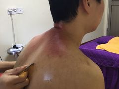-沈师傅盲人按摩工作室(密三小区店)
