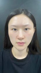 -素美医疗美容·西南眼鼻整形·修复基地