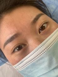 -美丽人生祛斑扁平疣汗管瘤中心