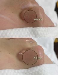 -SKIN79皮肤管理中心