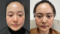 体验前-BR光电保养