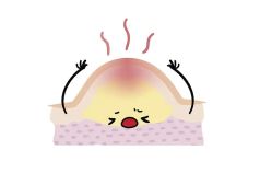 -碧莲盛·脱发养发中心