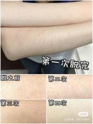 -中科妍美专业脱毛美肤连锁机构