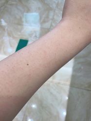 体验后-重庆军美医疗美容医院