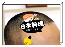 -大麦微针植发全国连锁