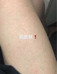 -倩极·精研痘敏肌管理