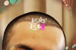 -大麦微针植发全国连锁