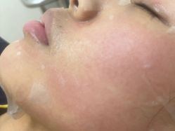 -长沙雅美医疗美容医院