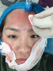 -天津健丽·去眼袋医疗美容机构