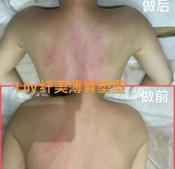 -Lily纤美·科技减脂中心