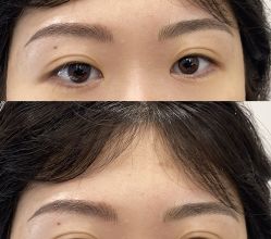 点击看大图 -张小野·专业半永久纹眉