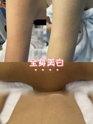 点击看大图 -ANNIL安奈尔·NASX超透白·科技抗衰·问题性肌肤管理