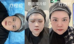 点击看大图 体验前-广州美莱医疗美容医院
