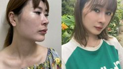 -恒博天姿医疗美容