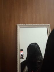 体验后-大麦微针植发全国连锁