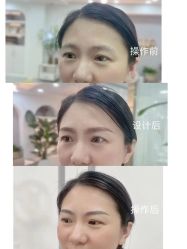 -Verywang半永久纹眉•仪器野生眉