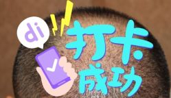 -大麦微针植发全国连锁